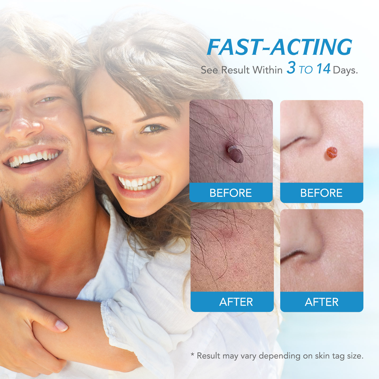 ideal for people who develop skin tags on a regular basis and need effective treatment.