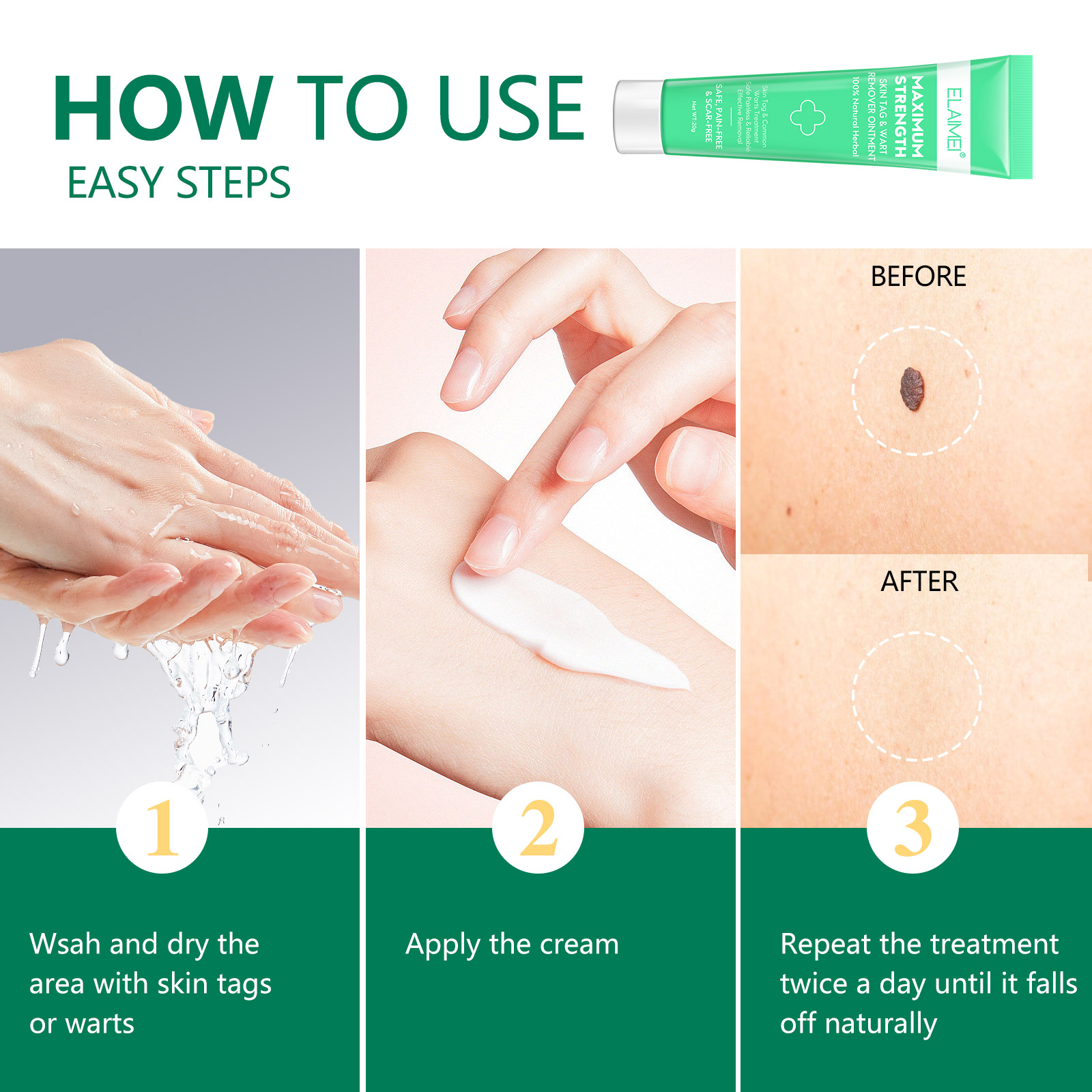 Elaimei Safe Skin Tag Remover Ointment Fast Mole Wart Removal Body Face Instant Treatment Fast Acting Natural Painless