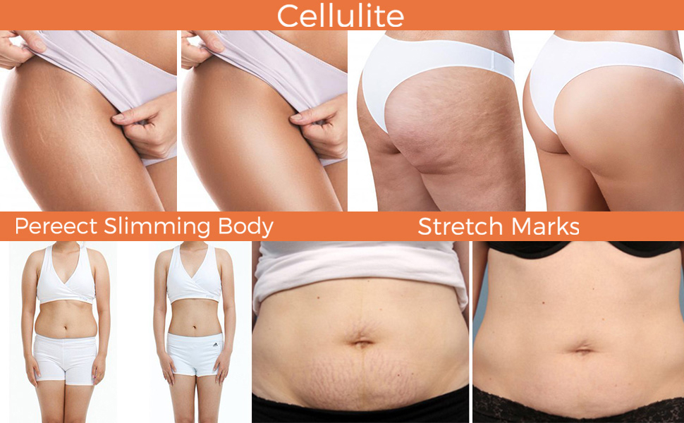 Anti Cellulite Cream, Hot Cream Natural Cellulite Treatment, Weight Loss Cream Belly Fat Burners for Women and Men Nature Ingredient