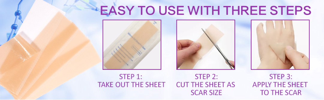 Scar Silicone Gel Sheet Patch Removal Skin Treatment Repair Wound Burn Efficient