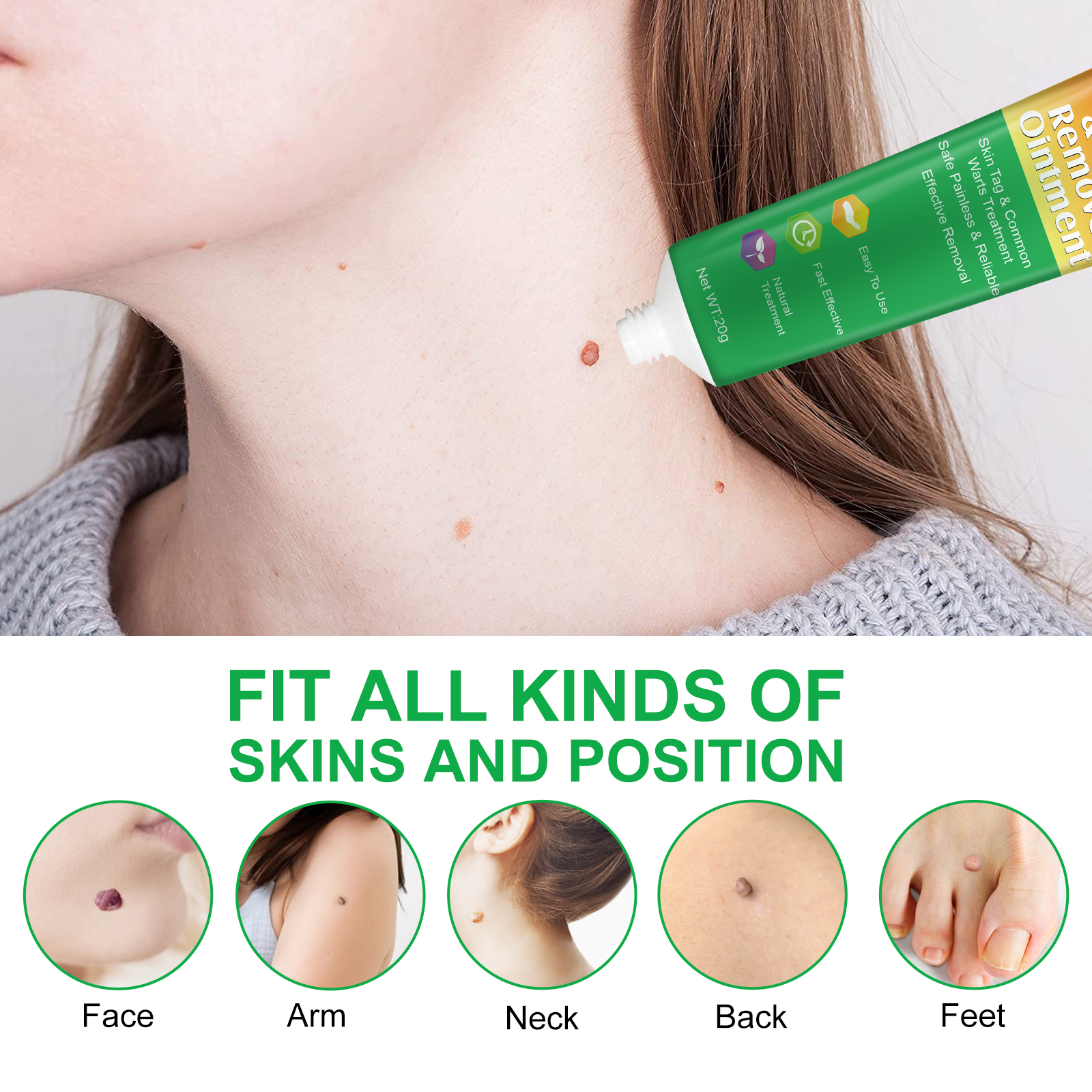 Aliver Fast Skin Tag Remover Ointment Safe Mole Wart Removal Body Face Instant Treatment Fast Acting Natural Painless