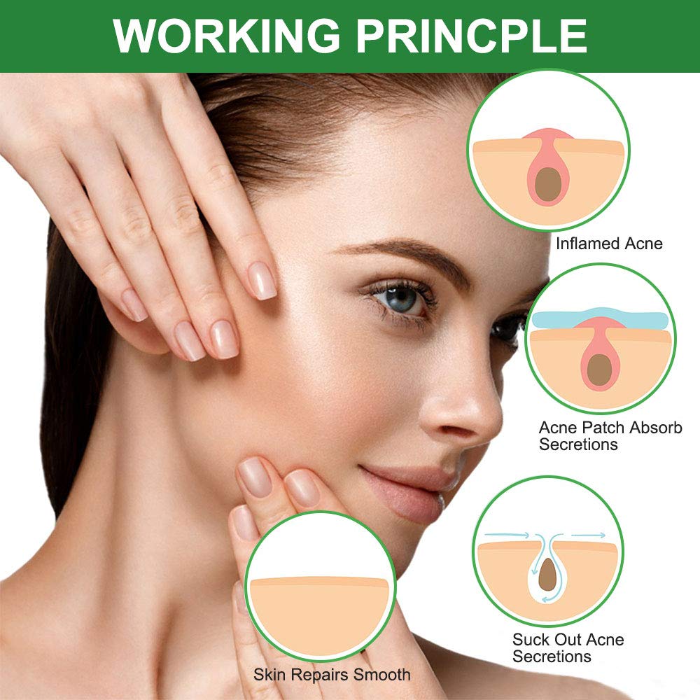Elaimei Natural Hydrocolloid Acne Pimple Remover 
