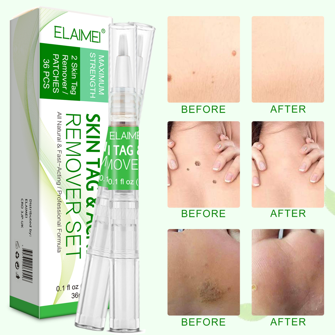 Elaimei 2n1 Skin Tag & Acne Remover Set
