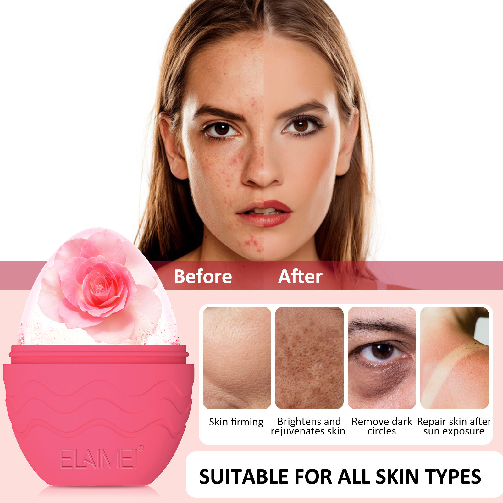 Elaimei Ice Facial Roller Acing Face Massager Skin Care Treatment Reusable Beauty Tool to Depuff Sculpt Face Shrink Pores Ball