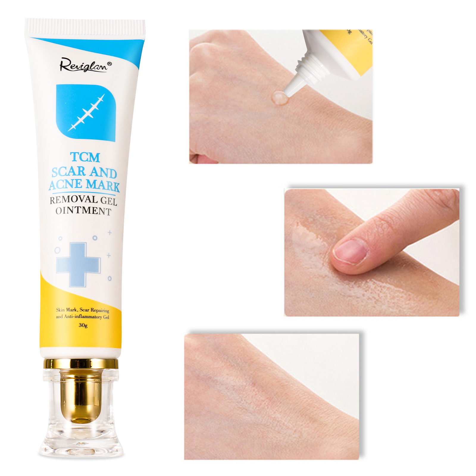 Reviglam TCM Scar And Acne Mark Removal Gel Cream Treatment Anti Stretch Skin Spots Marks Old Scars Burn Repair Remover
