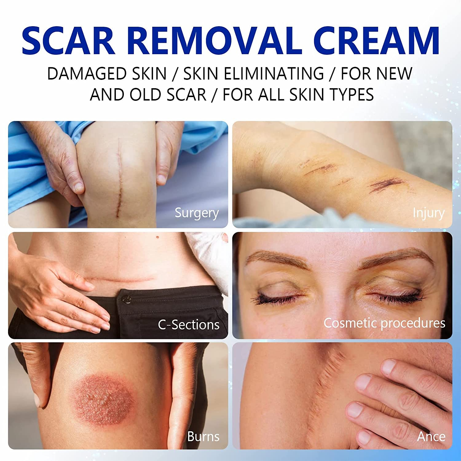 Elaimei Scar Removal Cream, 50ml