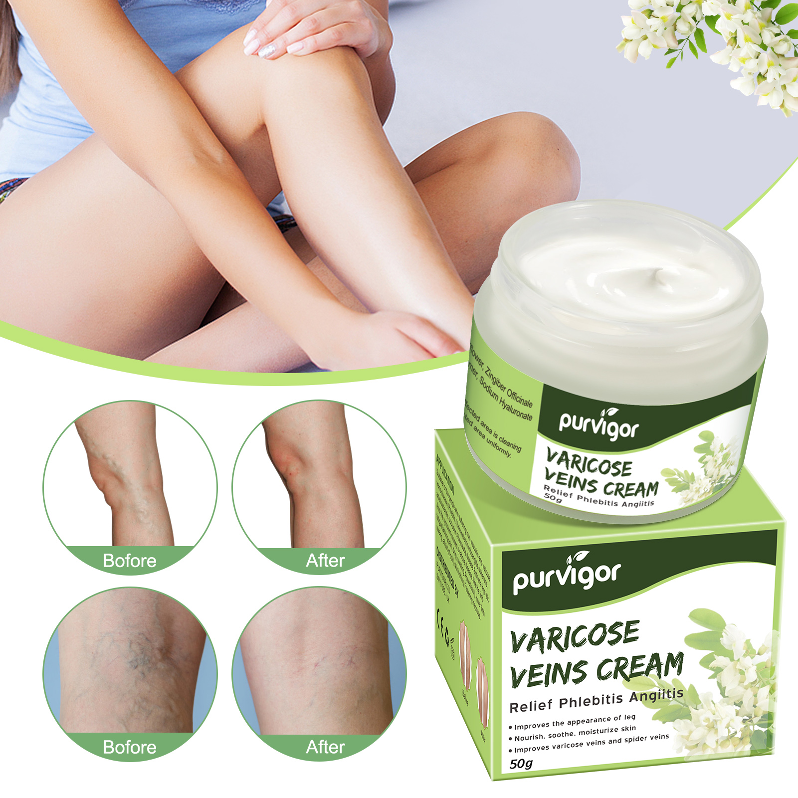 PURVIGOR Removal Varicose Veins Treatment Cream Anti Spider Stretch Marks Vasculitis Advanced Legs Health Repair Support Phlebitis