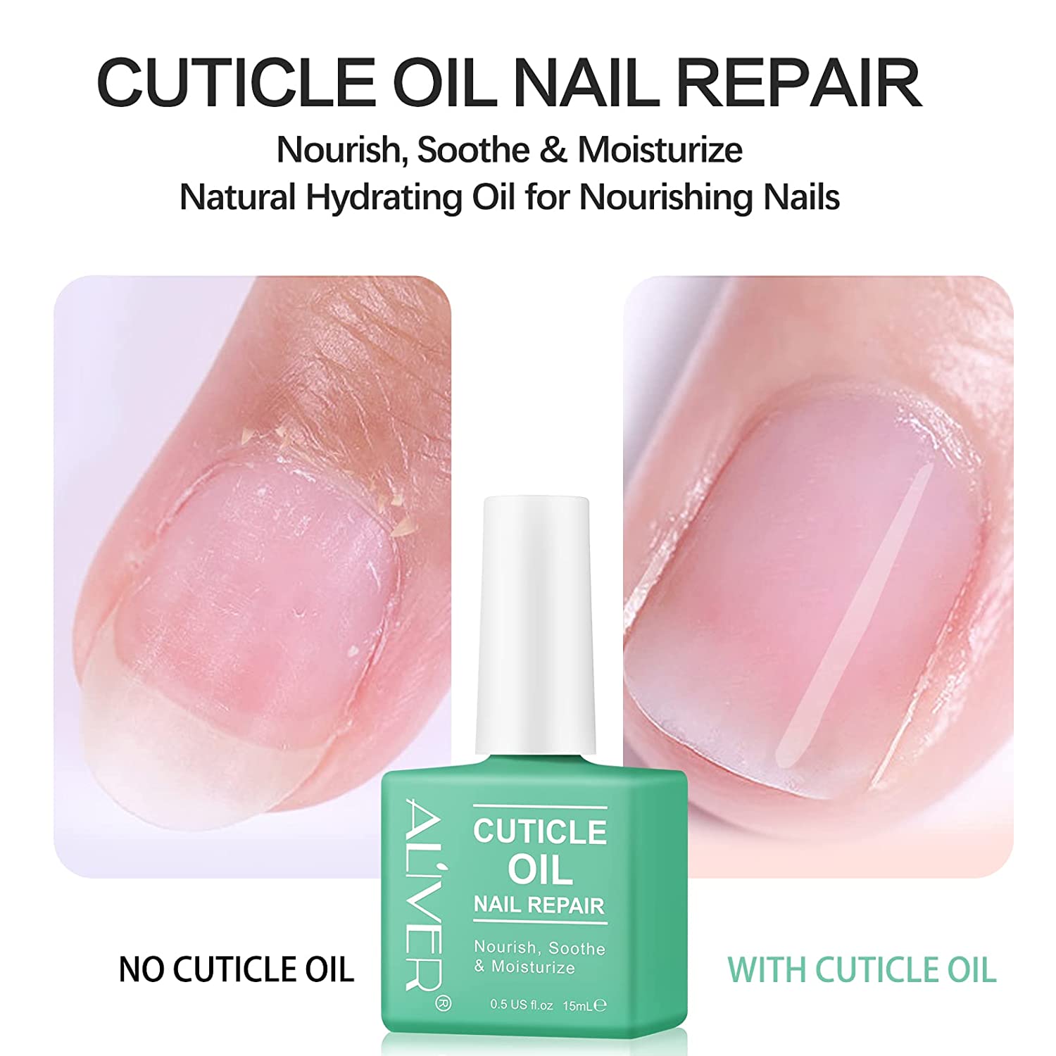 Aliver Cuticle Oil for Nail Repair, 15ml