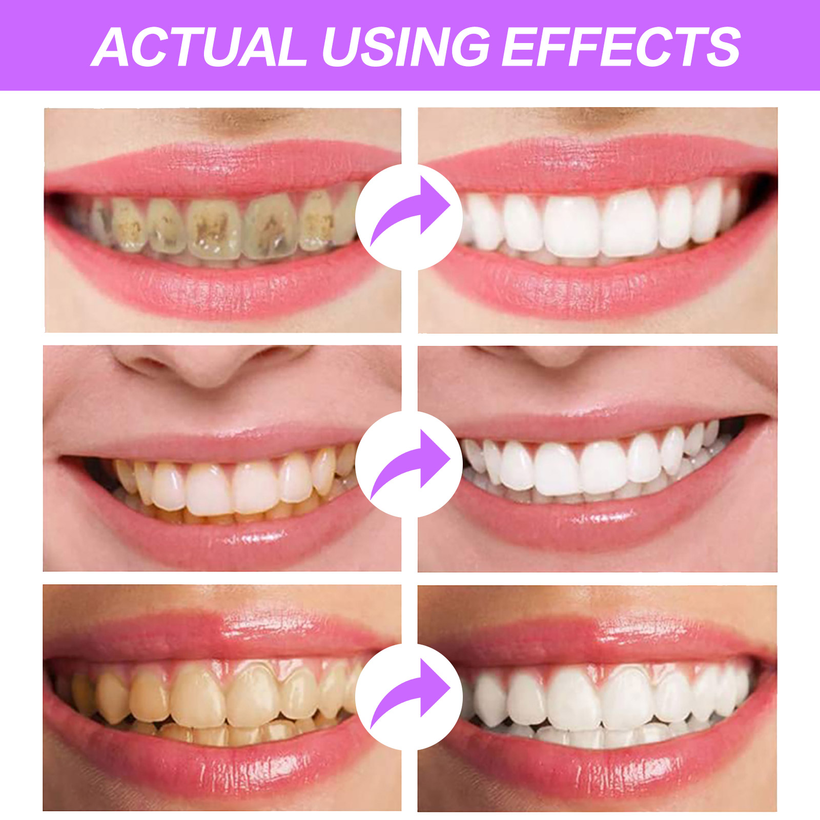 Sefudun Whitening ToothPaste Teeth Hygiene Stain Removal Color Corrector Sensitive Gums Strengthens Restore Enamel Brightening