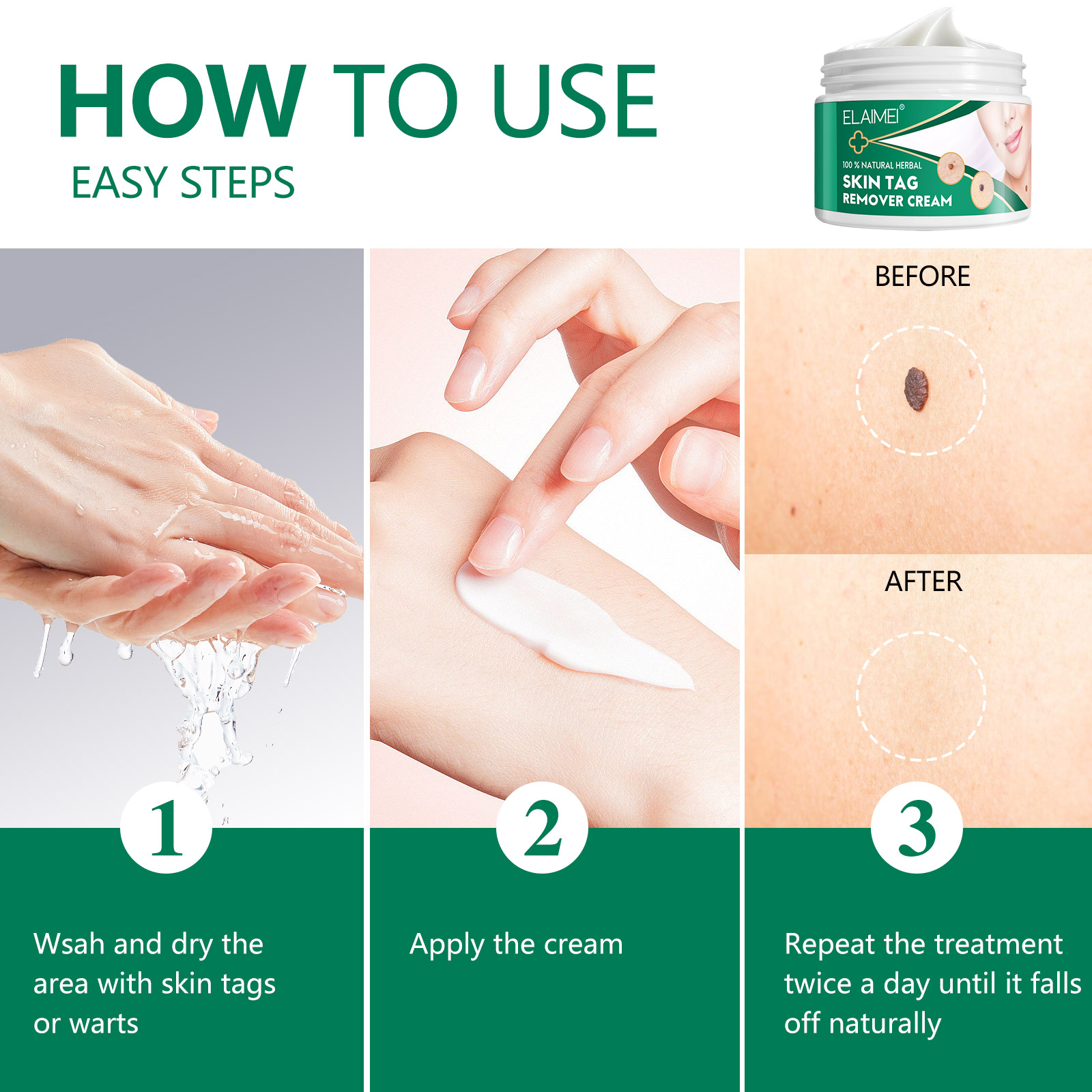 Elaimei Fast Skin Tag Remover Wart Treatment Cream Safe Instant Mole Removal Body Face Acne Pimple Spot Effective Micro Painless Natural Repair