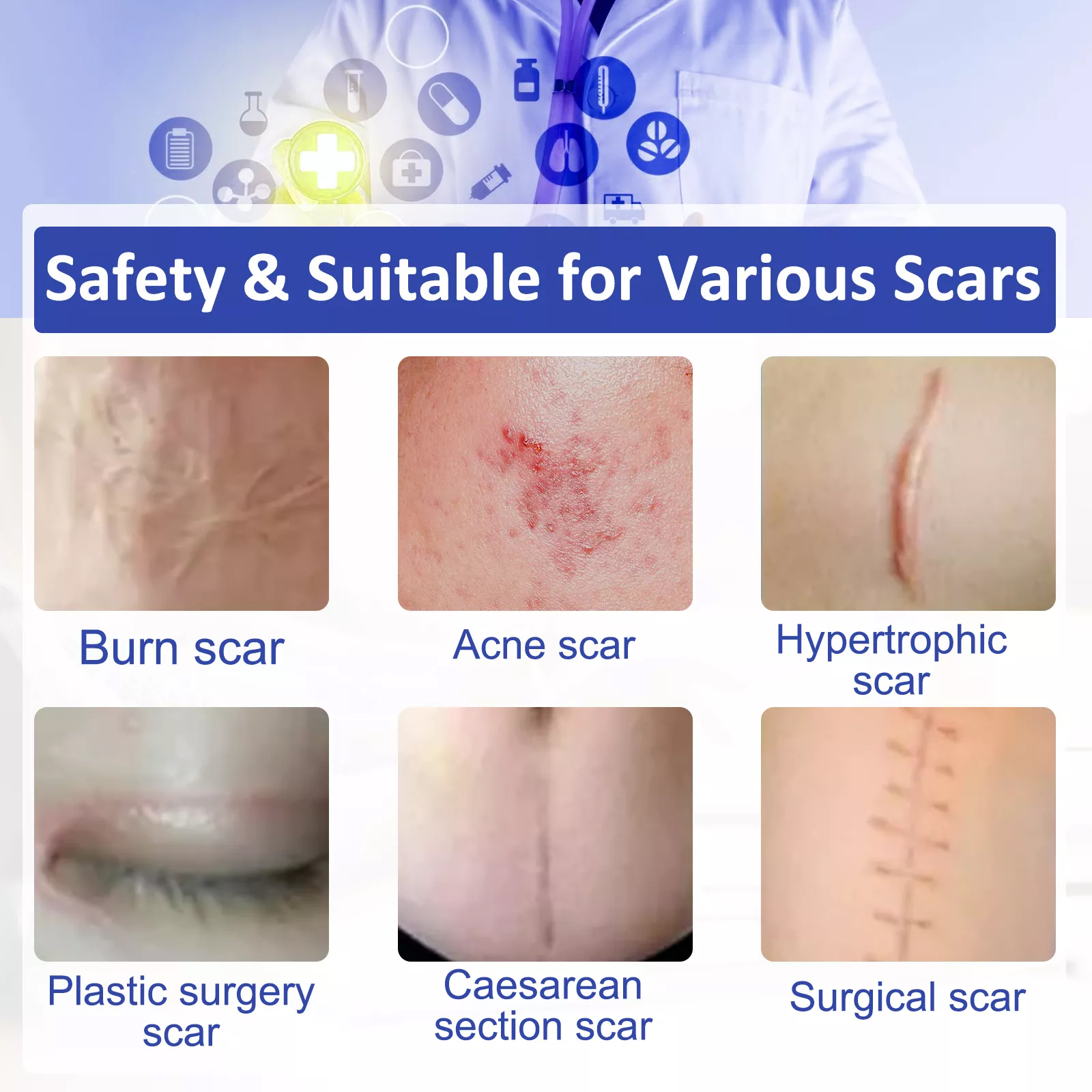 Ideal For Various Scars Our Scar Tape is ideal for a variety Elaimei 3m Silicone Gel Tape Roll for Scar Removal